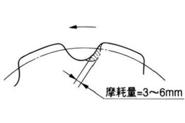 歯面の摩耗