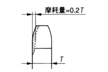 歯の側面の摩耗