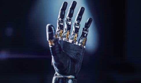 Prosthetic Arm